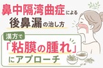 鼻中隔湾曲症による後鼻漏の治し方｜漢方で「粘膜の腫れ」にアプローチ