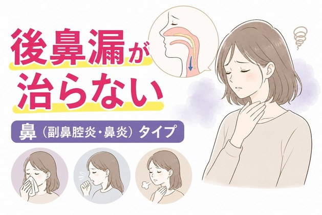 後鼻漏が治らない原因｜鼻（副鼻腔炎・鼻炎）タイプに多い7つの特徴と「排泄力」の関係