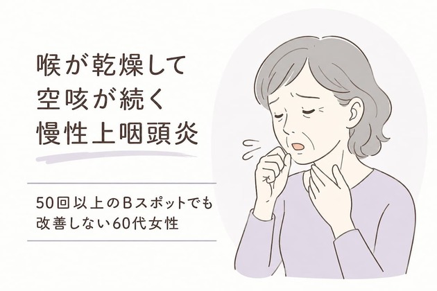 喉が乾燥して空咳が続く慢性上咽頭炎｜50回以上のBスポットでも改善しない60代女性