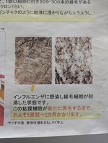 慢性上咽頭炎（じょういんとうえん）・後鼻漏(こうびろう）